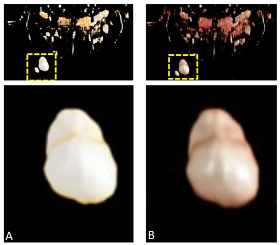Diagnostics 15 00033 g008