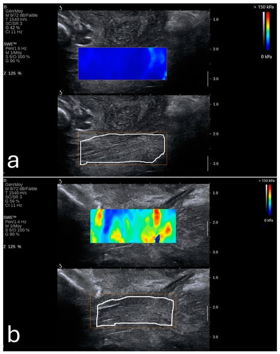 Diagnostics 15 00047 g003