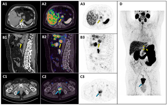 Diagnostics 15 00101 g001