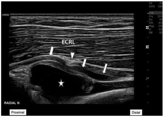 Diagnostics 15 00124 g002