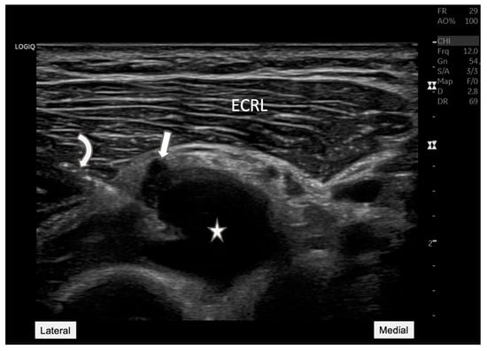 Diagnostics 15 00124 g004