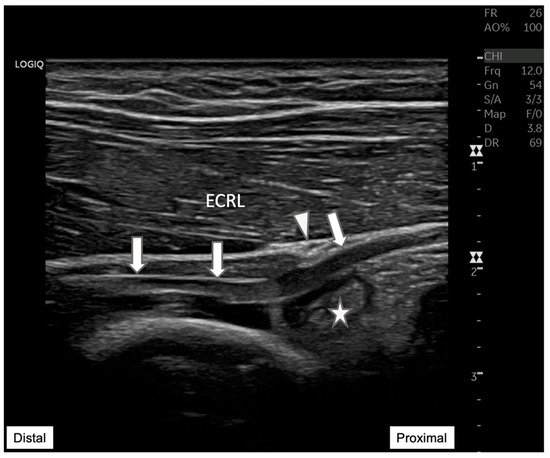 Diagnostics 15 00124 g005