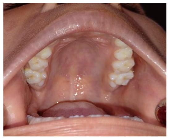 Diagnostics 15 00134 g001