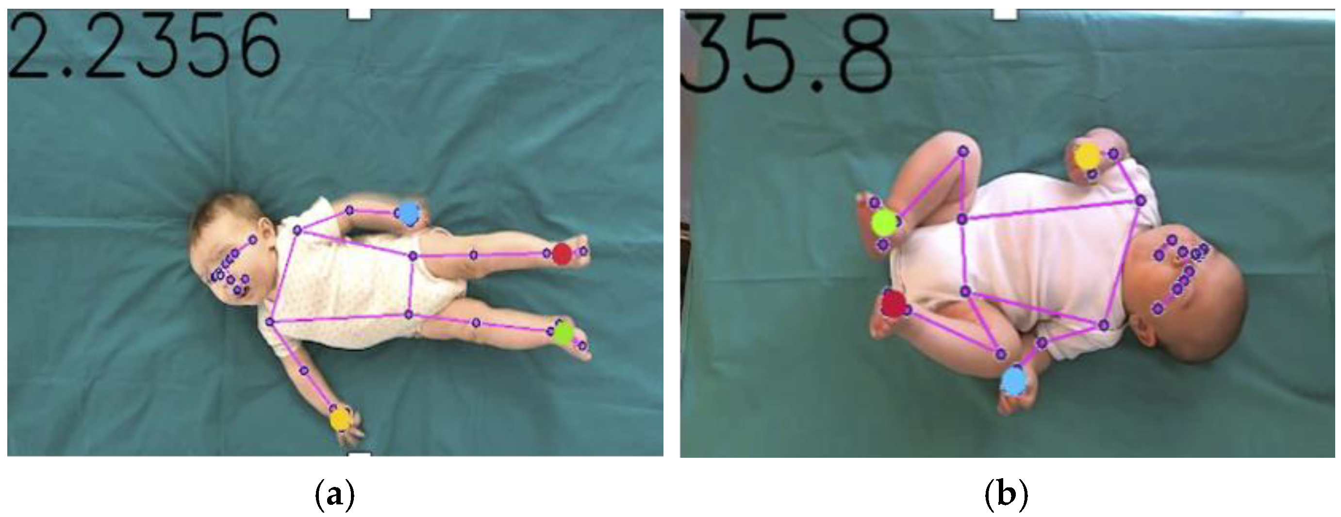 Diagnostics 15 00136 g003