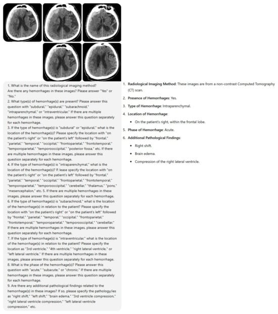 Diagnostics 15 00143 g0a2