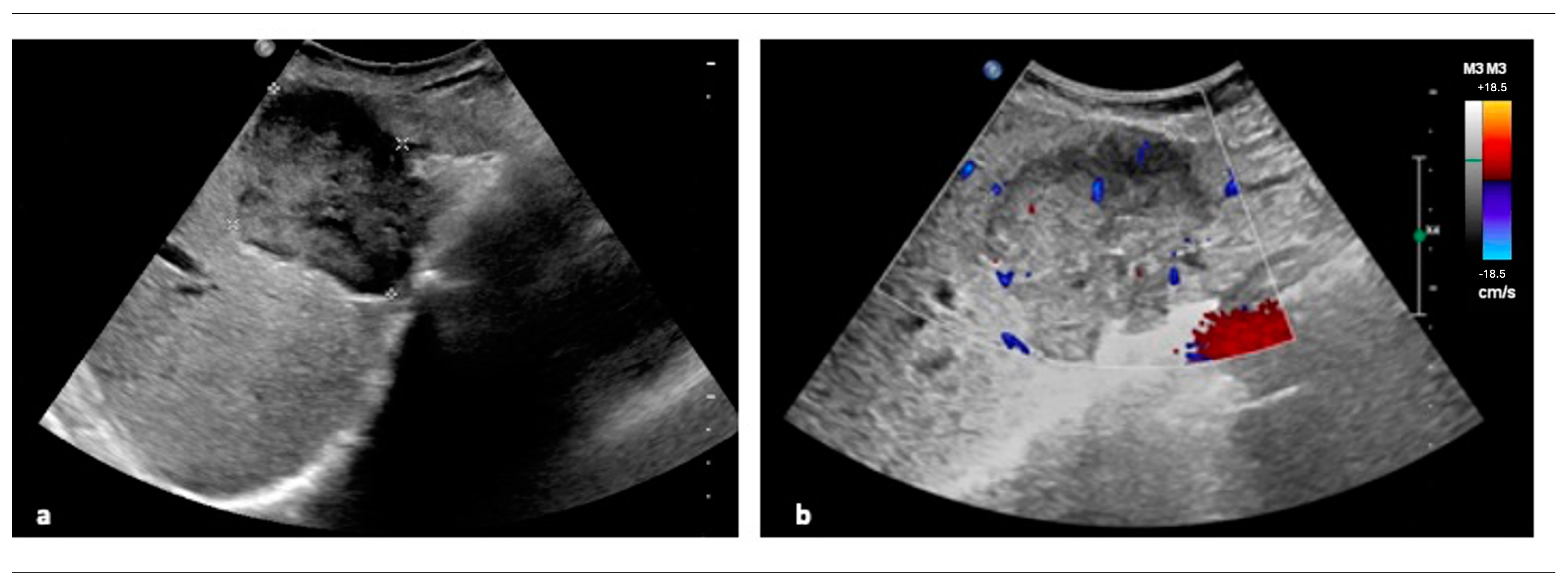 Diagnostics 15 00148 g001