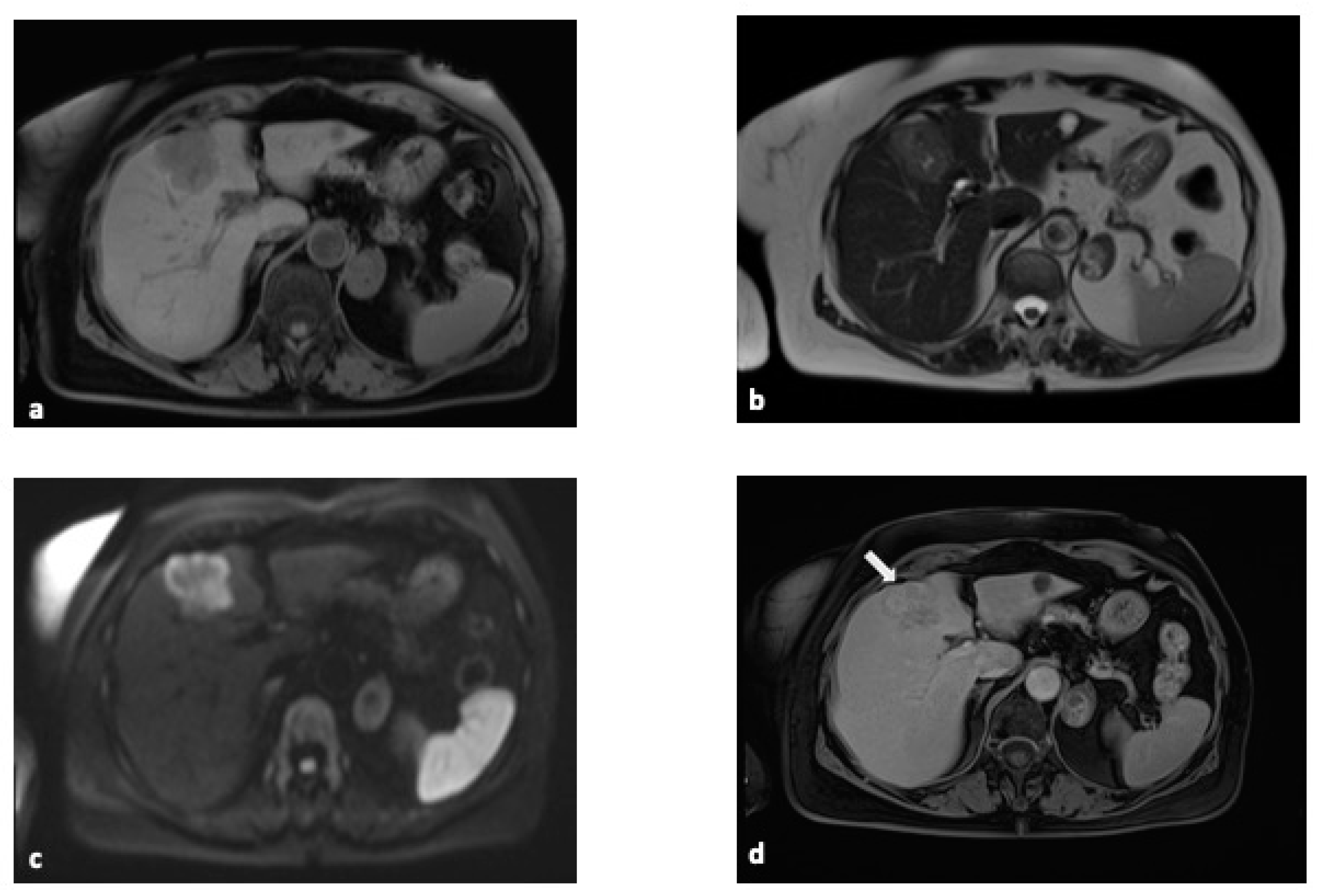 Diagnostics 15 00148 g003