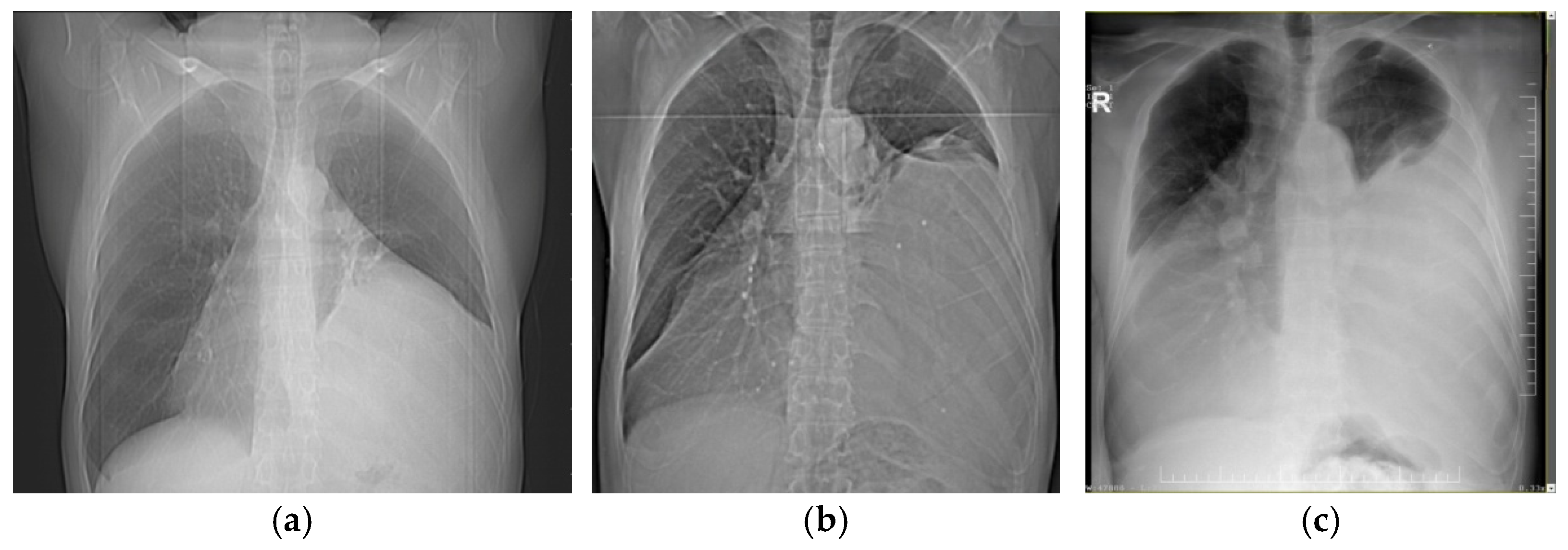 Diagnostics 15 00159 g002