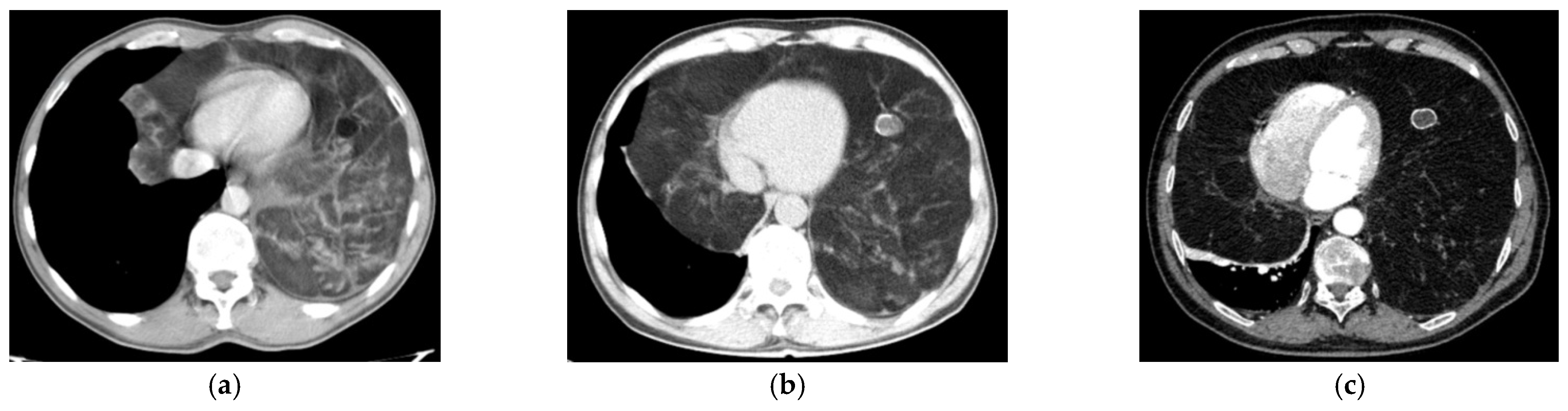 Diagnostics 15 00159 g003