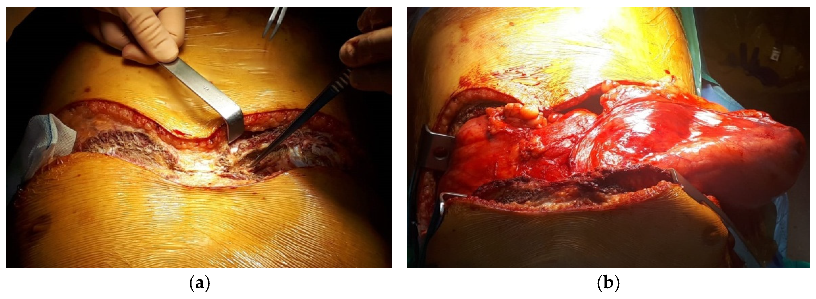 Diagnostics 15 00159 g004