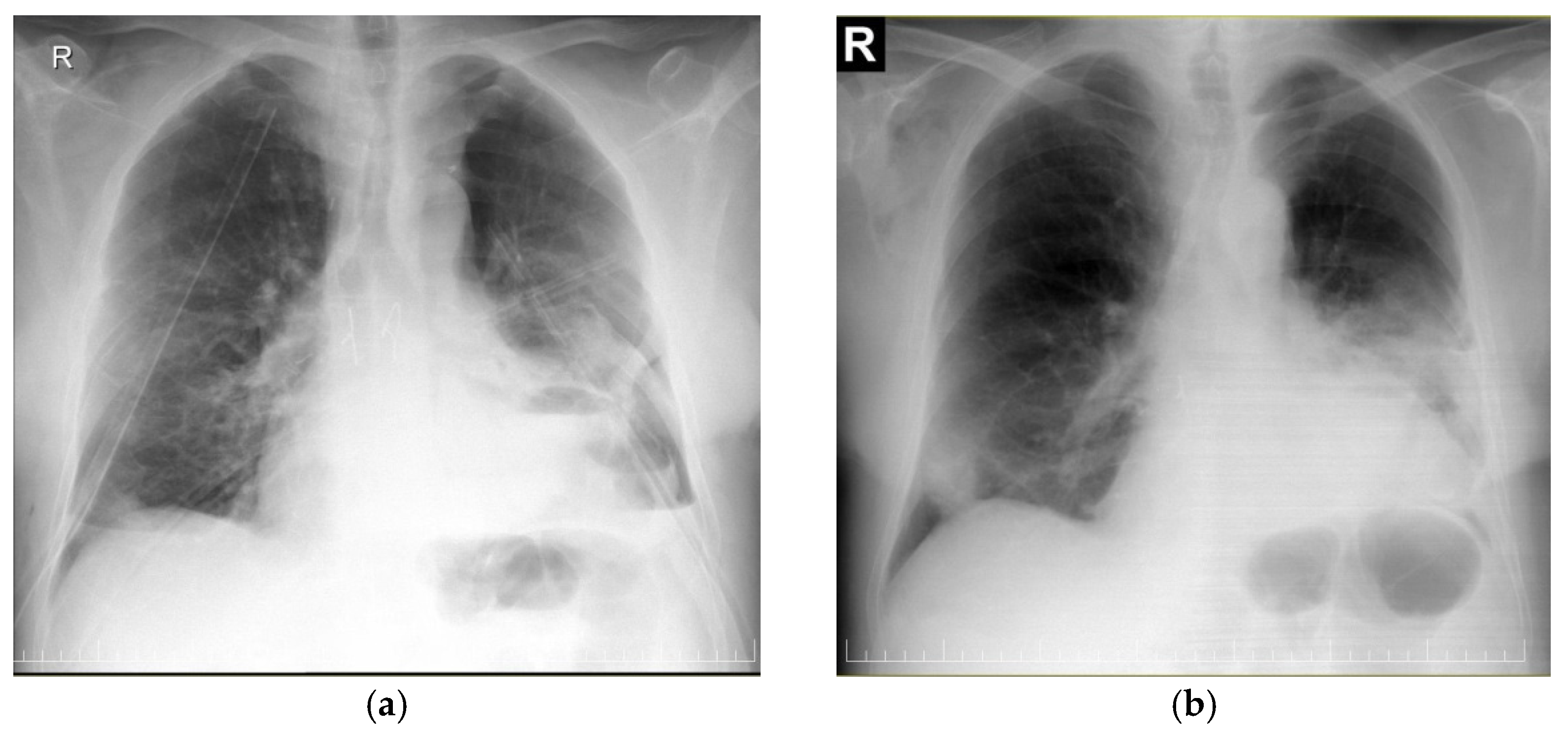 Diagnostics 15 00159 g006