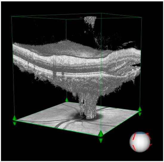 Diagnostics 15 00174 g001