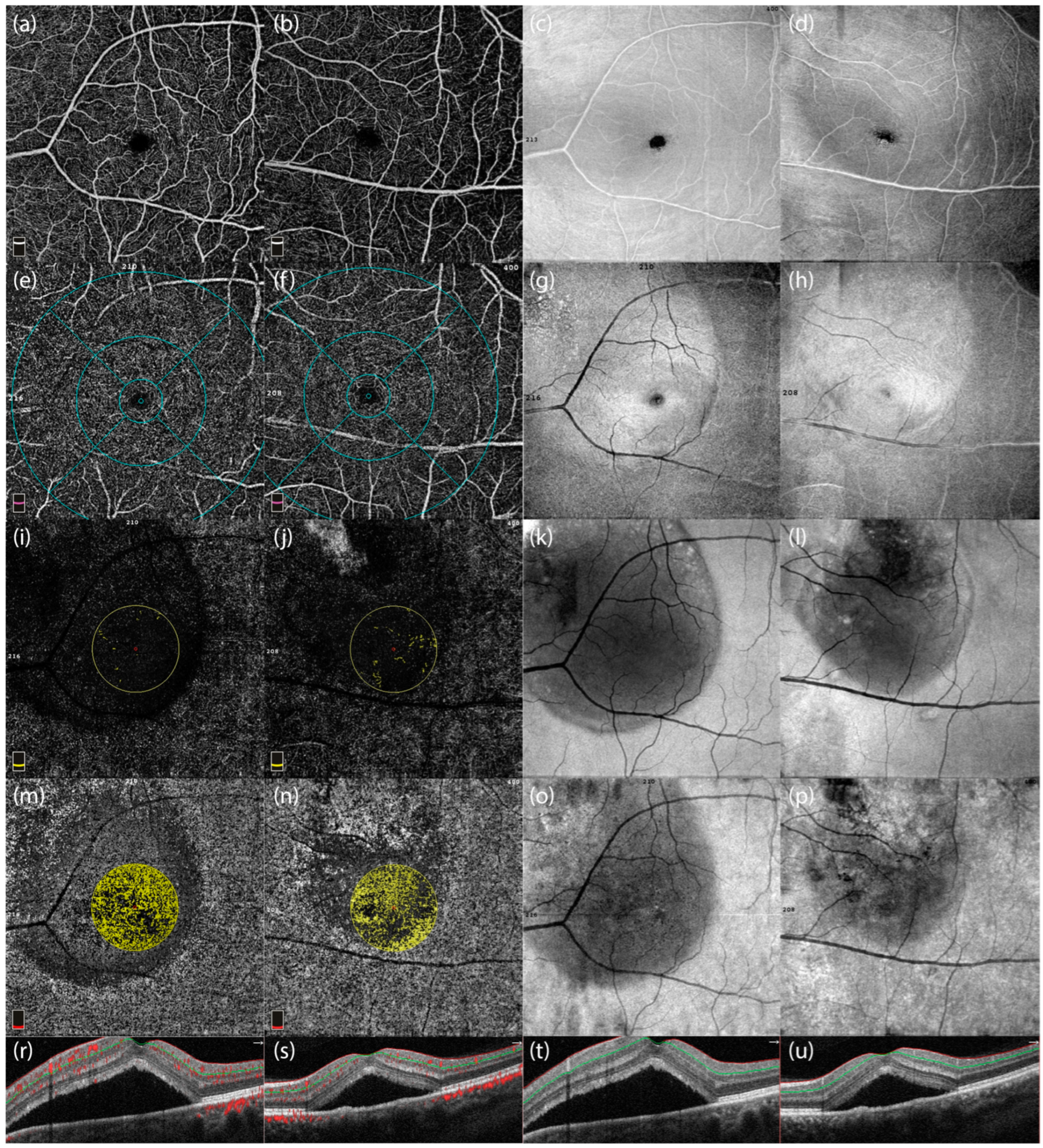 Diagnostics 15 00174 g004