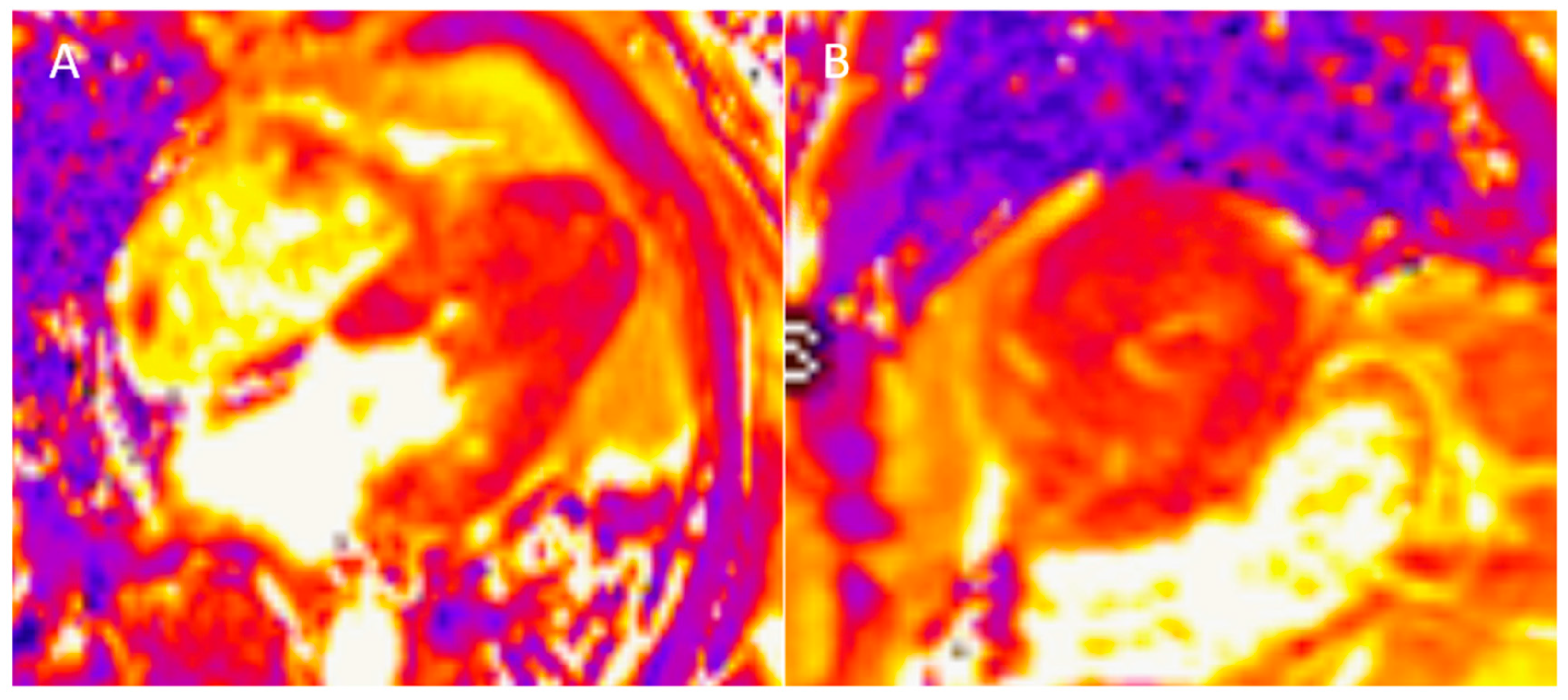 Diagnostics 15 00178 g004