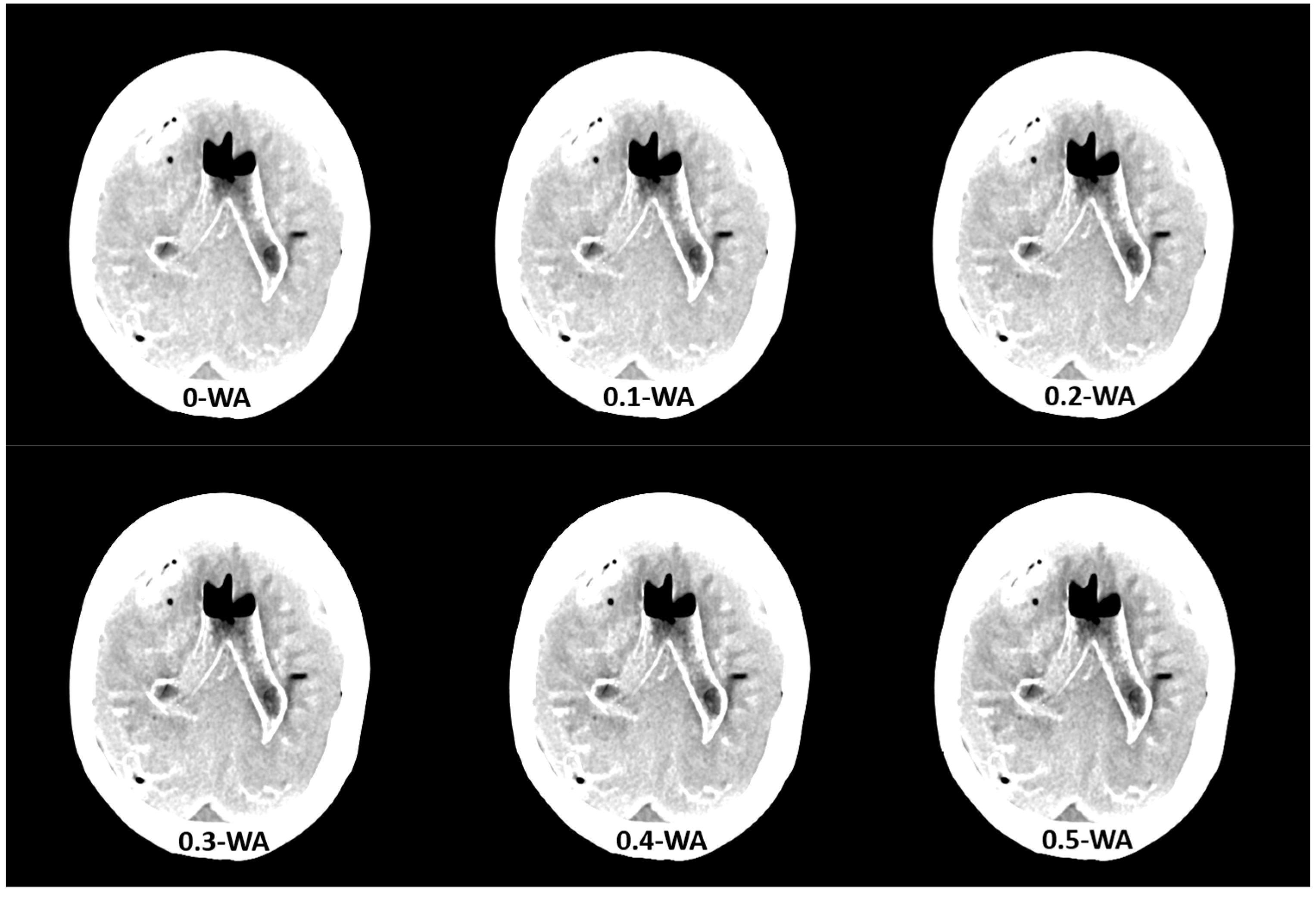 Diagnostics 15 00180 g002a