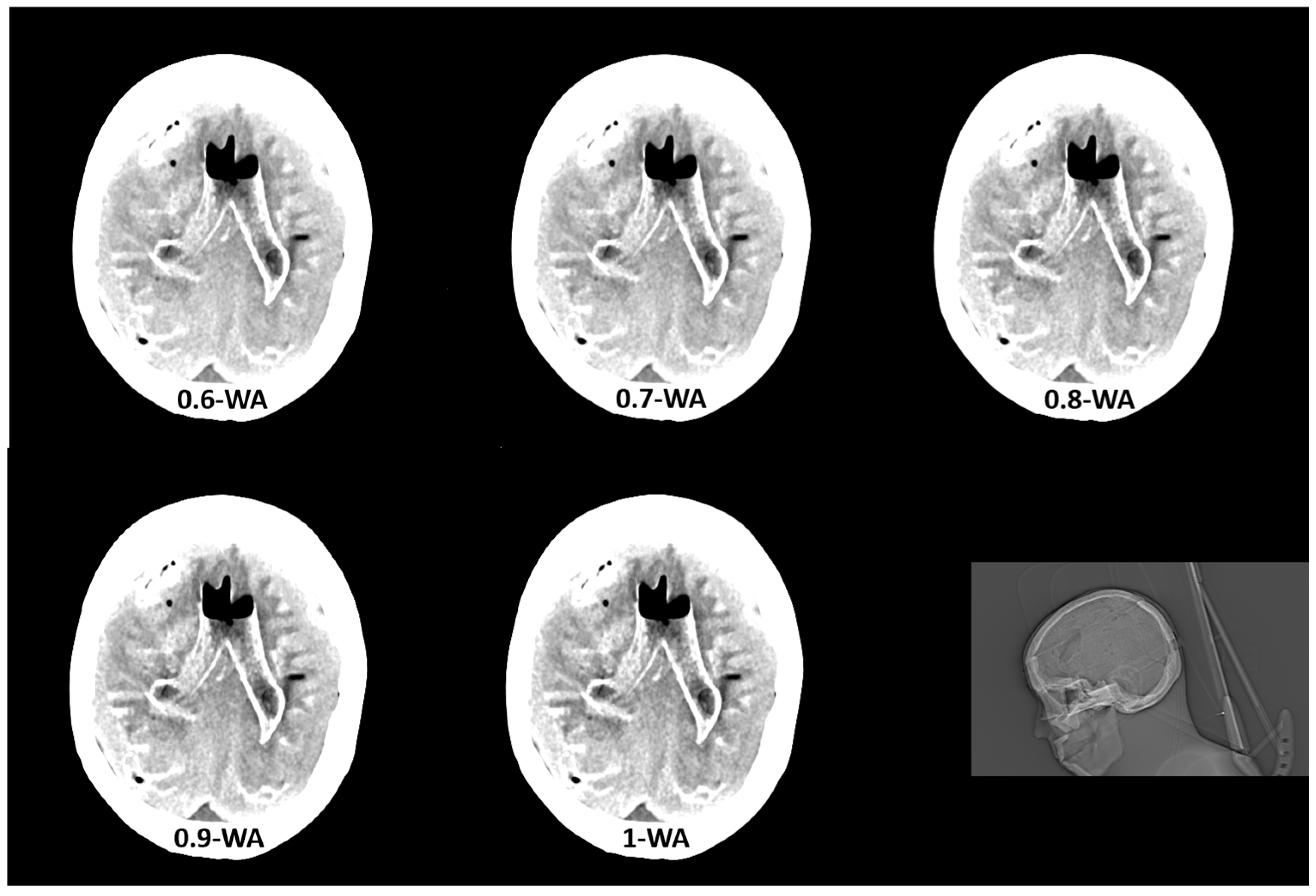 Diagnostics 15 00180 g002b
