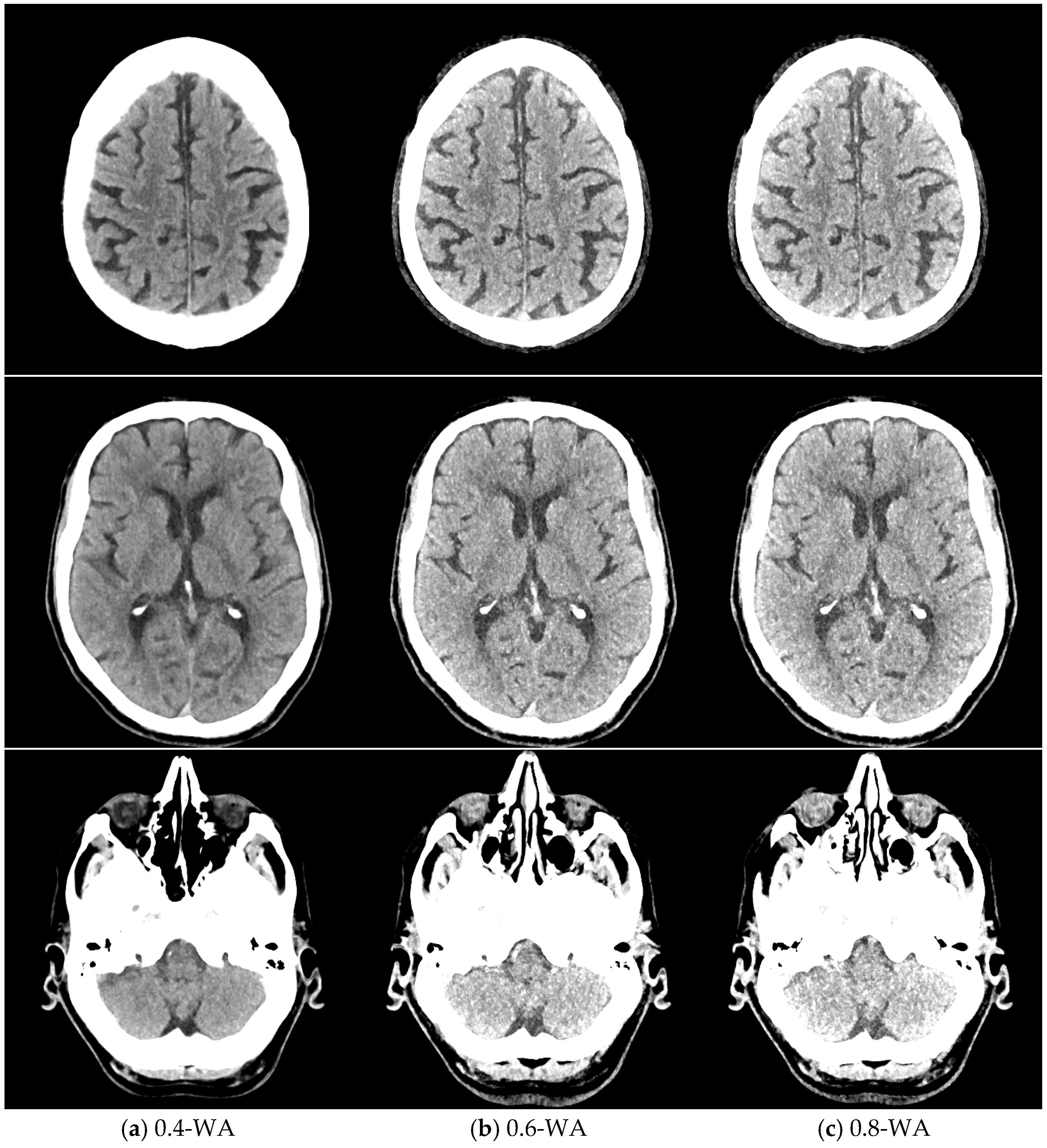 Diagnostics 15 00180 g005