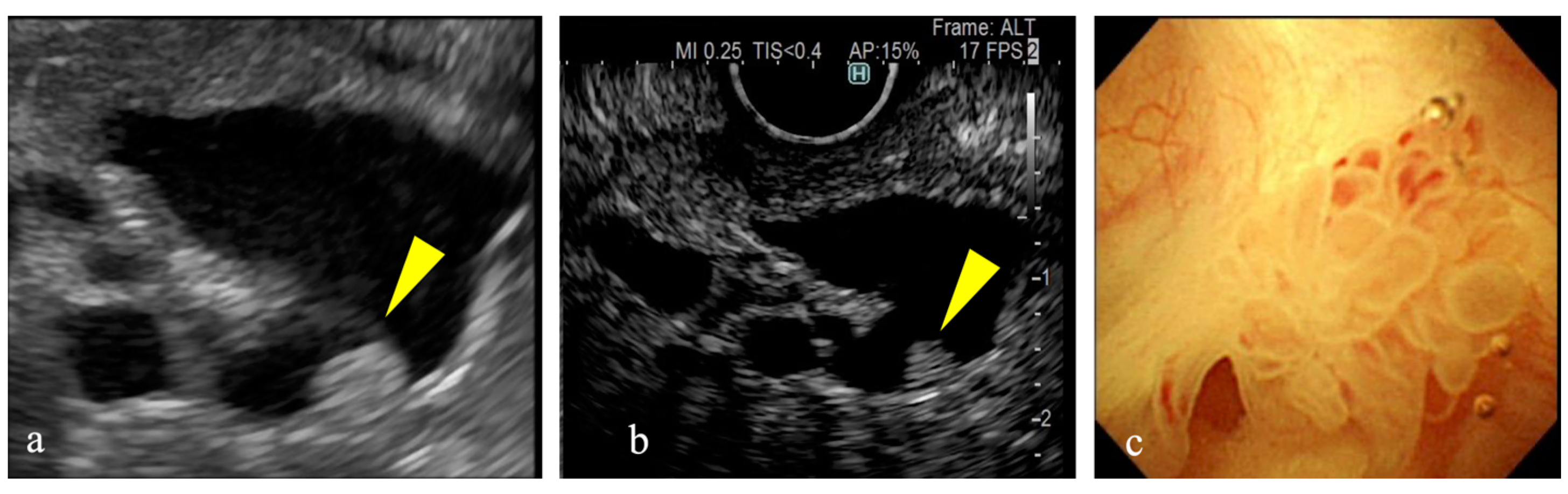 Diagnostics 15 00196 g002