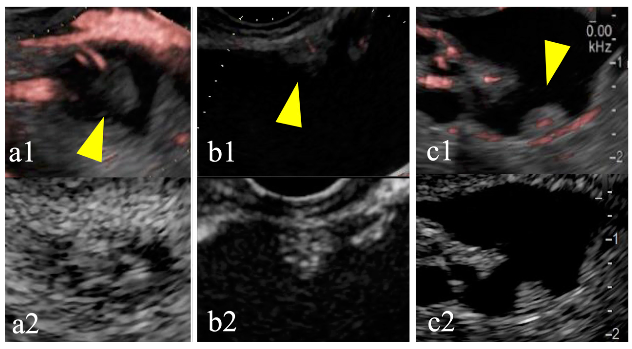 Diagnostics 15 00196 g004