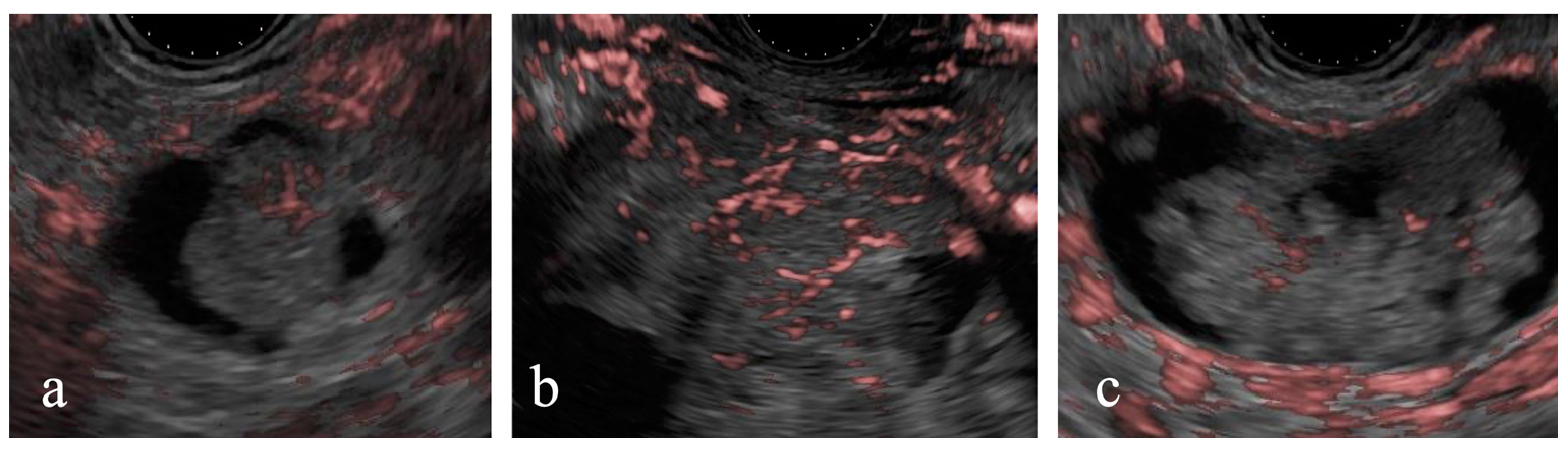 Diagnostics 15 00196 g005