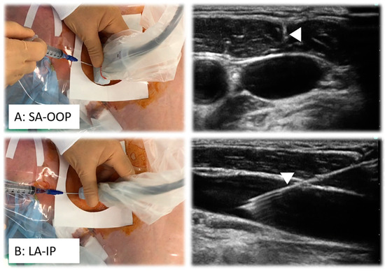 Diagnostics 15 00197 g003