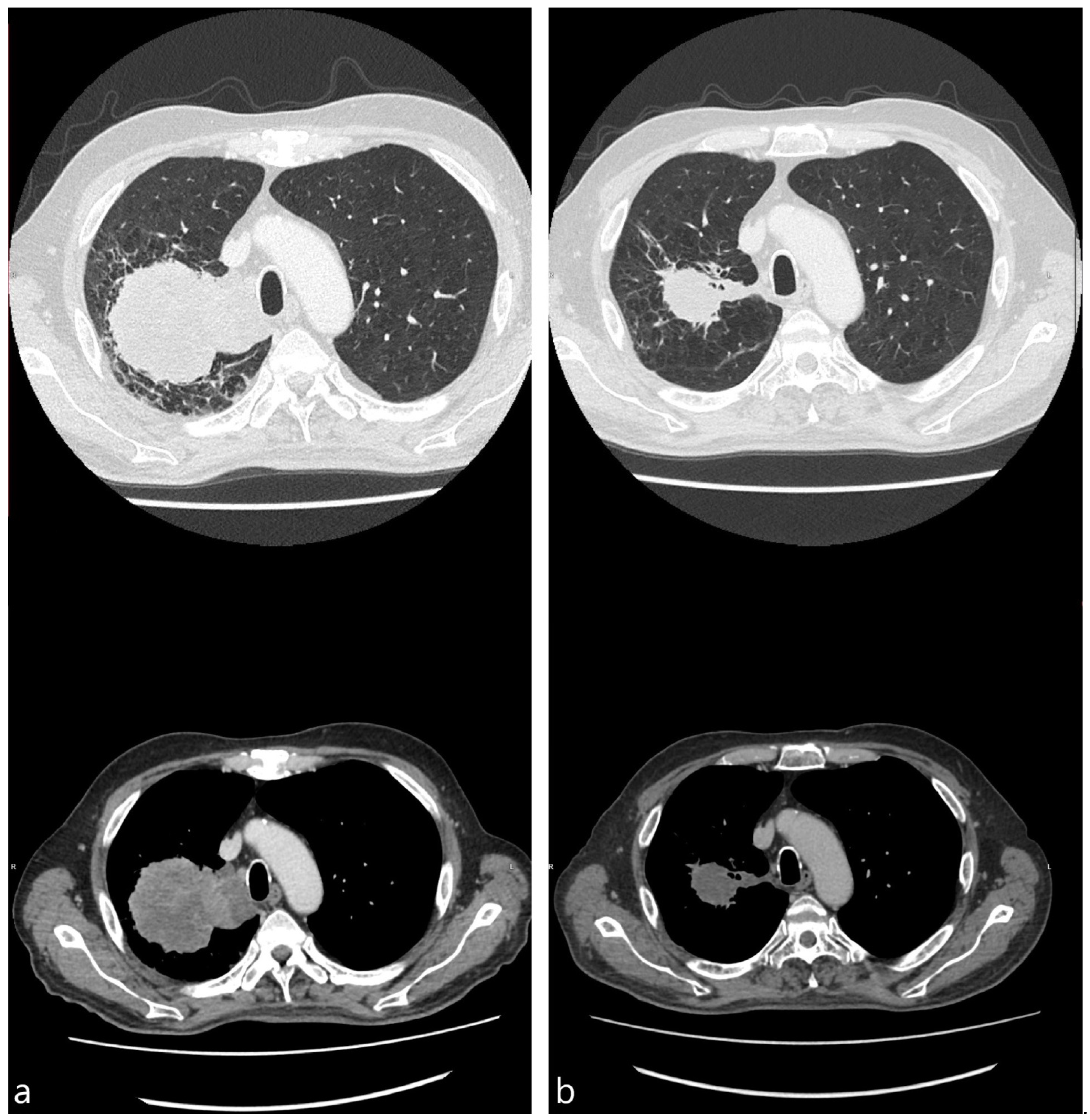 Diagnostics 15 00201 g003