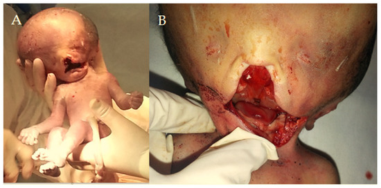 Diagnostics 15 00202 g001a Diagnostics 15 00202 g001a