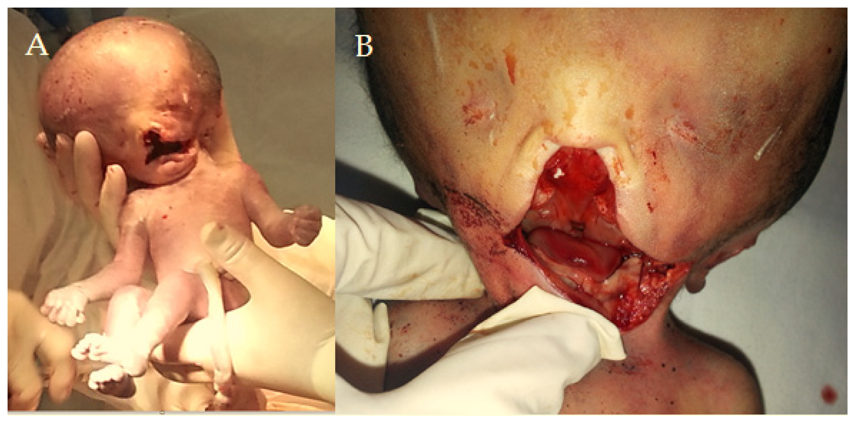 Diagnostics 15 00202 g001a Diagnostics 15 00202 g001a