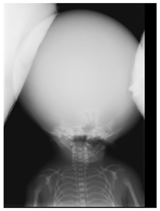 Diagnostics 15 00202 g002