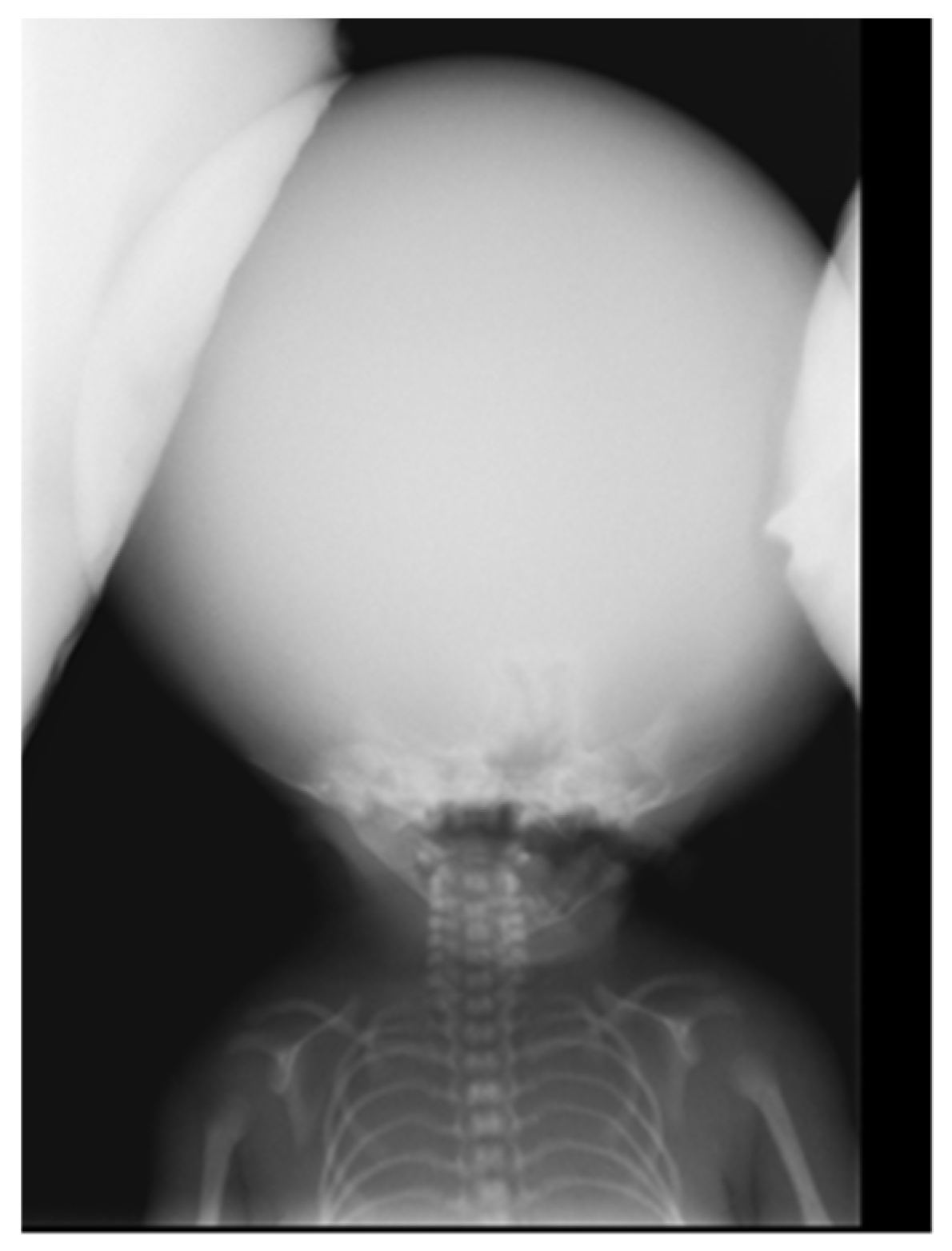 Diagnostics 15 00202 g002 Diagnostics 15 00202 g002