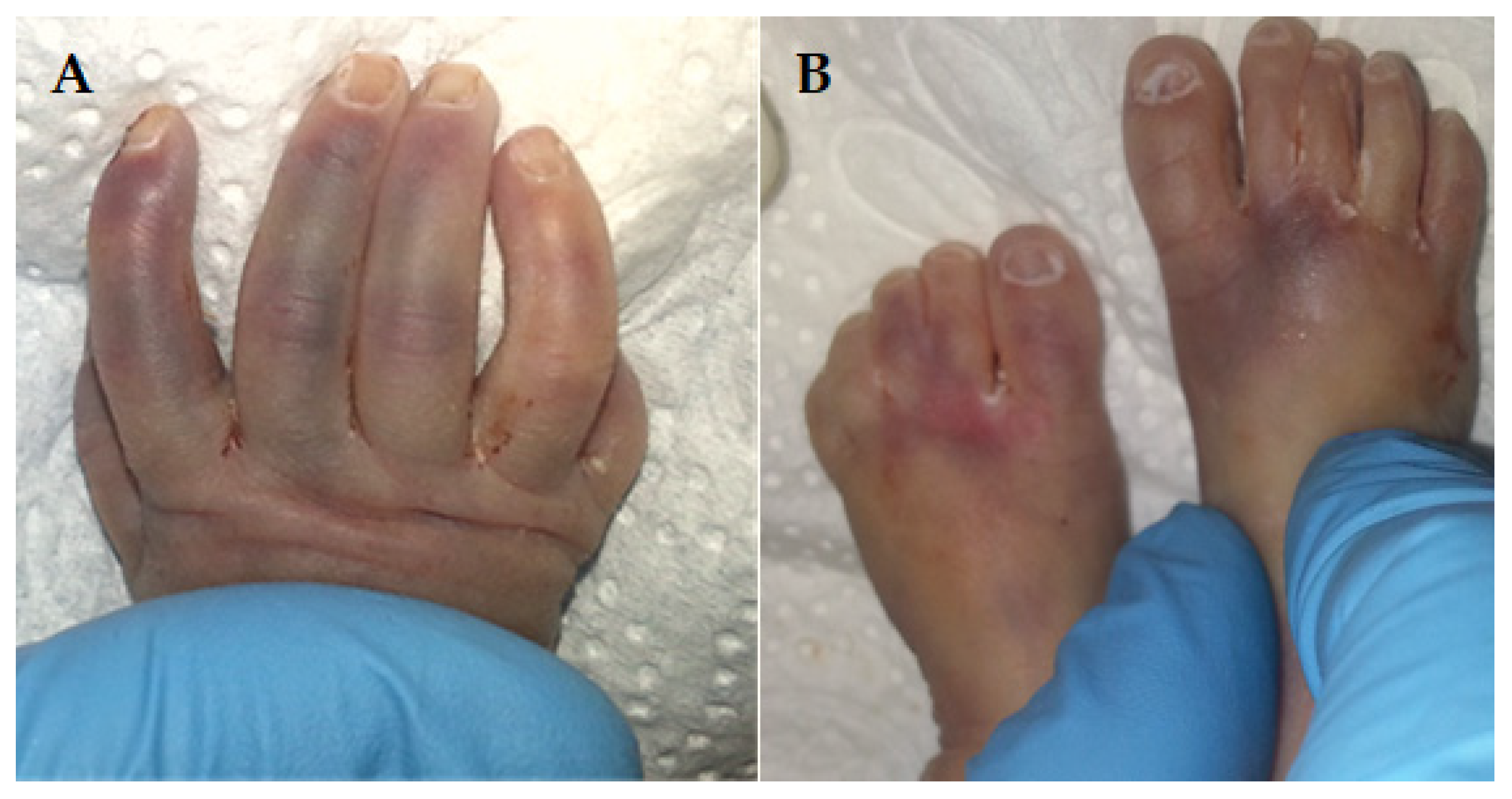 Diagnostics 15 00202 g003 Diagnostics 15 00202 g003