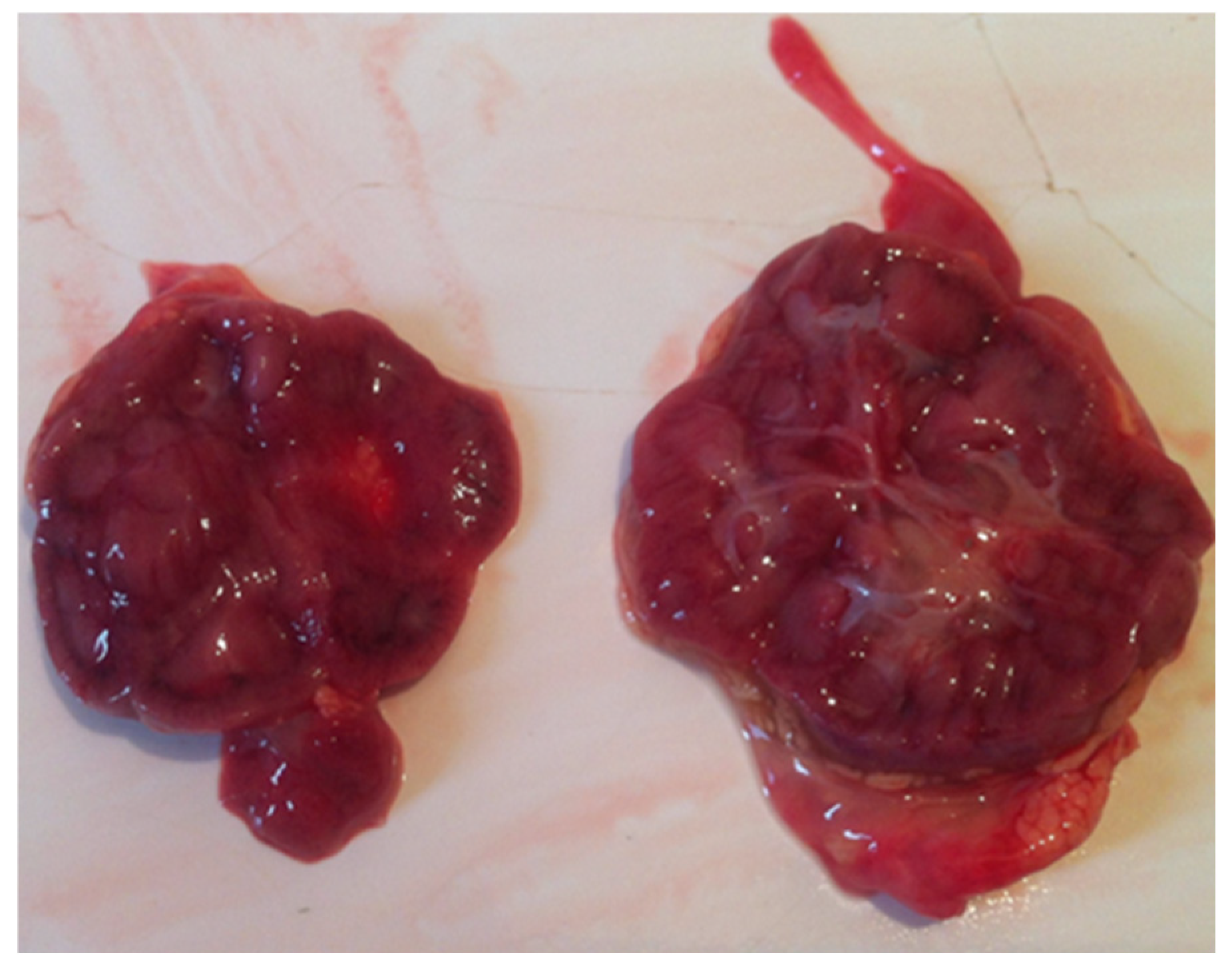 Diagnostics 15 00202 g004 Diagnostics 15 00202 g004