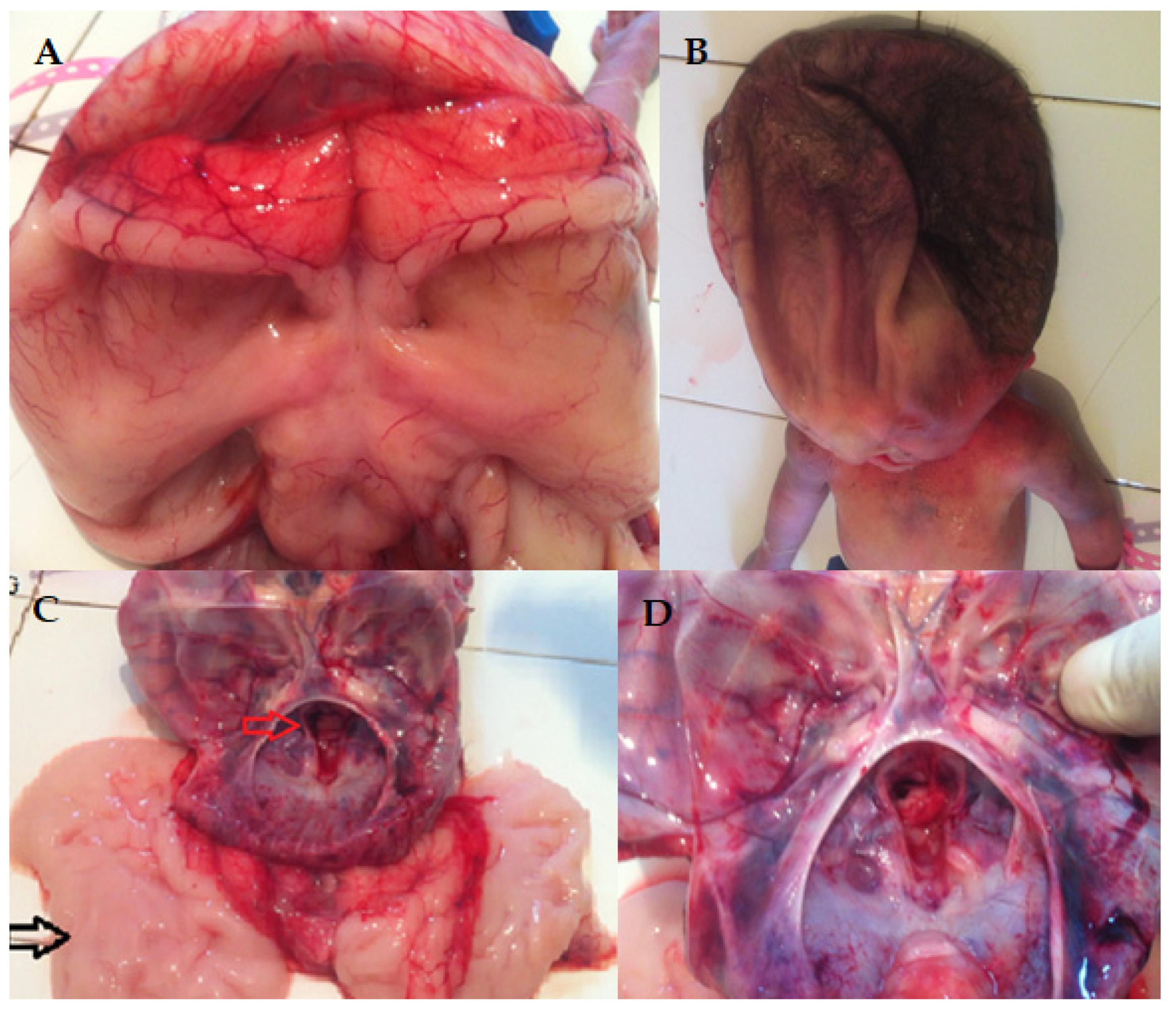 Diagnostics 15 00202 g005 Diagnostics 15 00202 g005