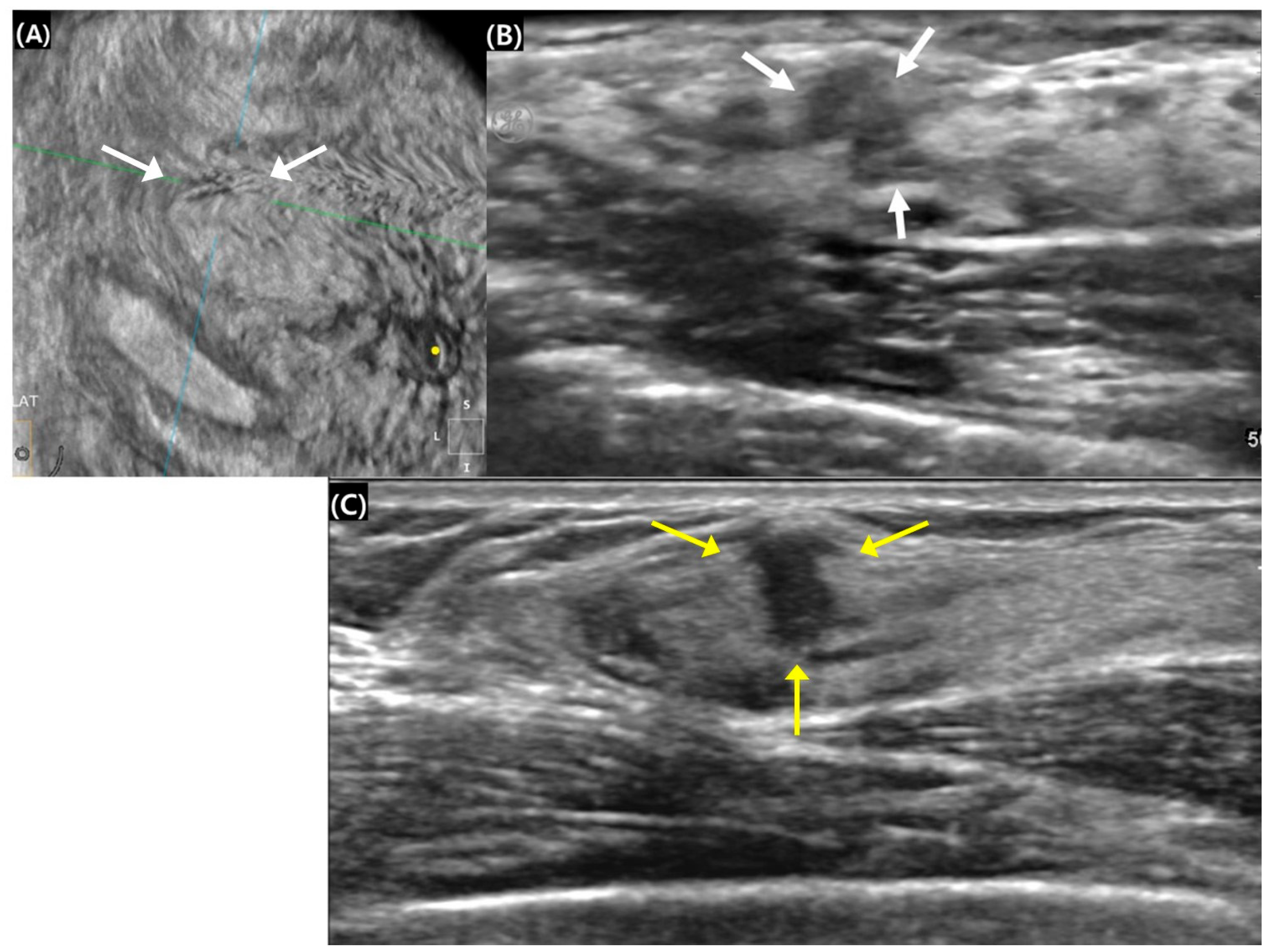 Diagnostics 15 00212 g001