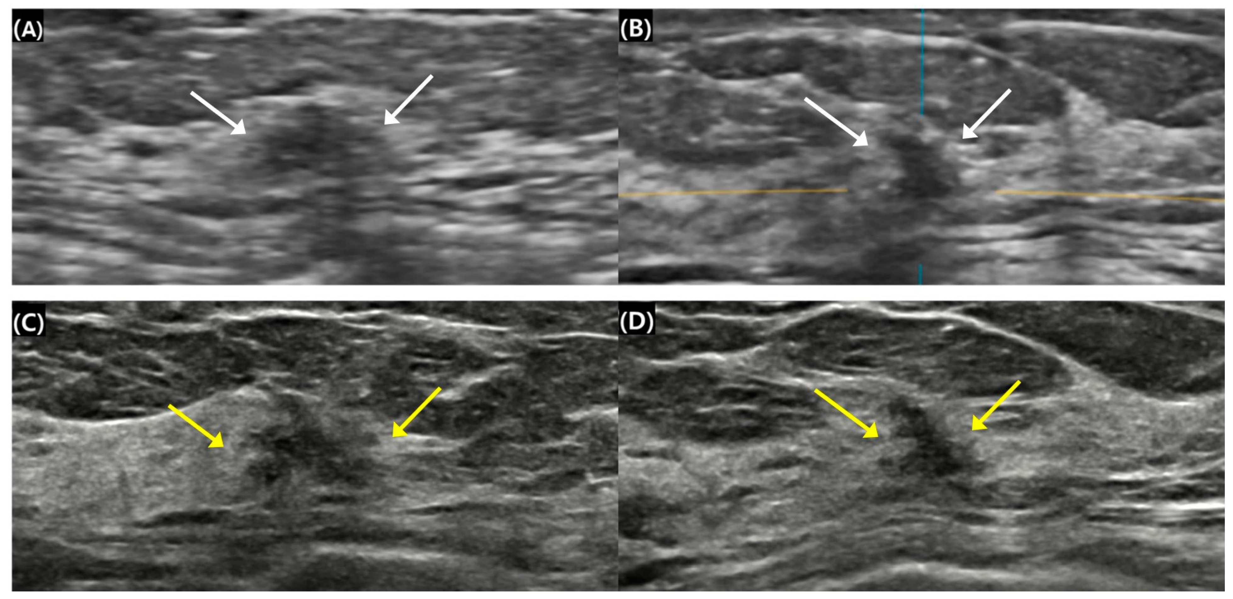 Diagnostics 15 00212 g002