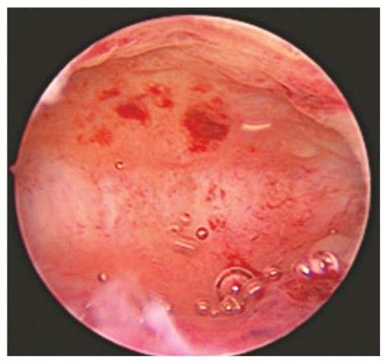 Diagnostics 15 00243 g002