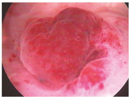 Diagnostics 15 00243 g003