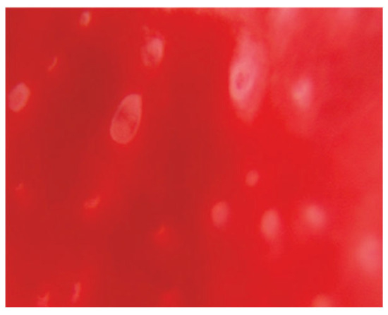 Diagnostics 15 00243 g004