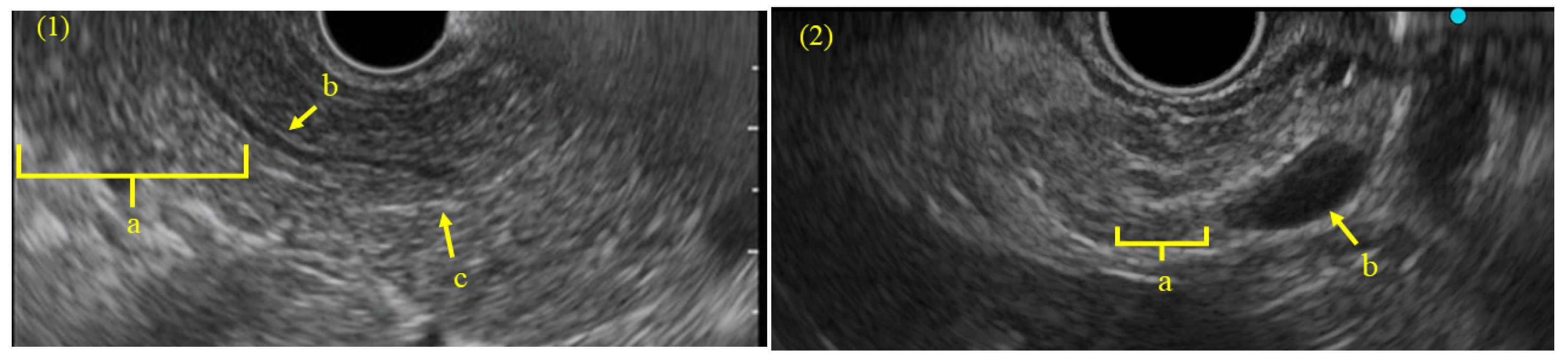 Diagnostics 15 00253 g002