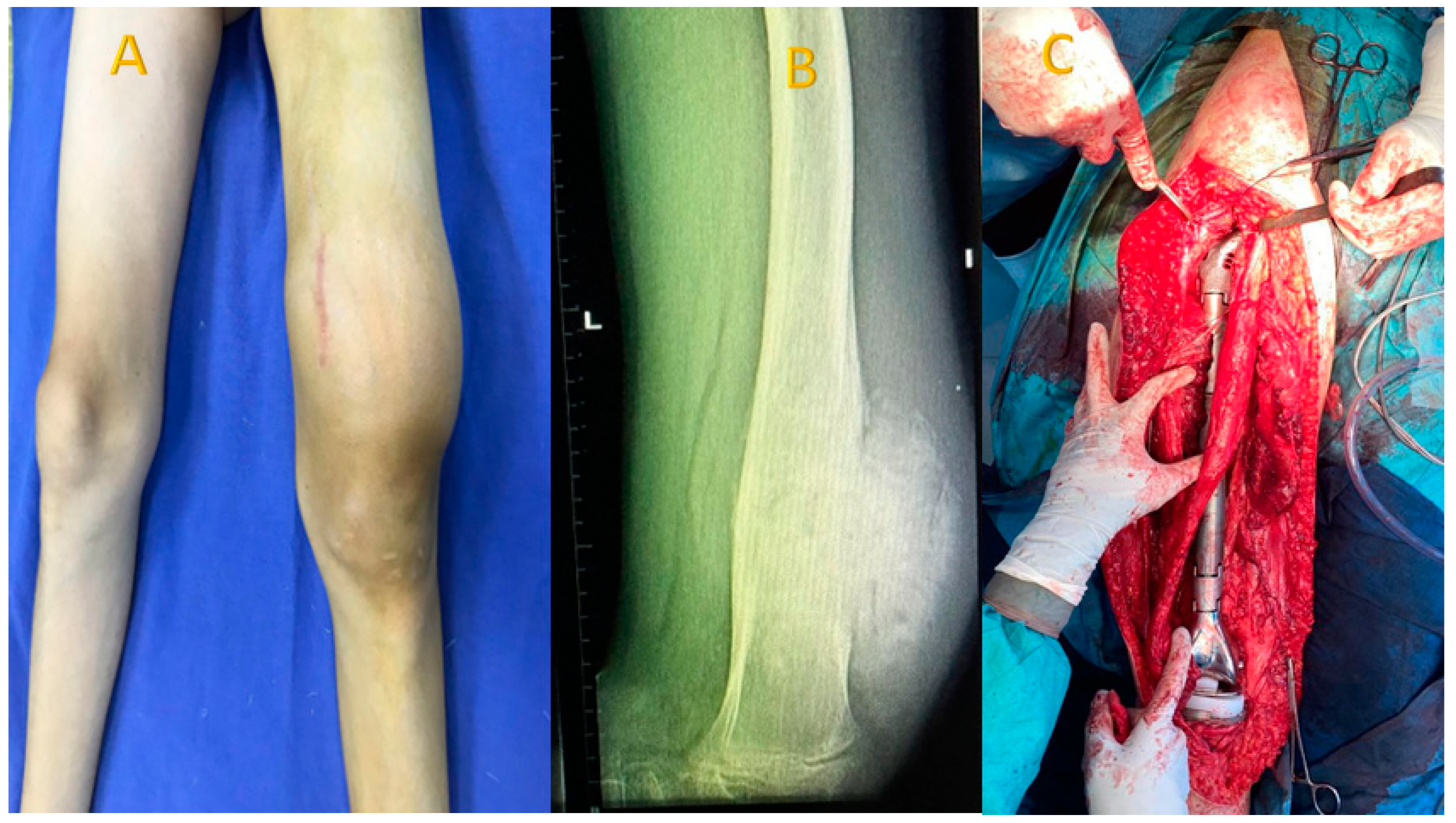 Diagnostics 15 00266 g004