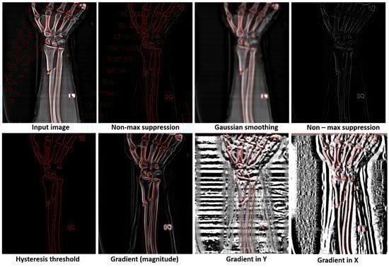 Diagnostics 15 00271 g006