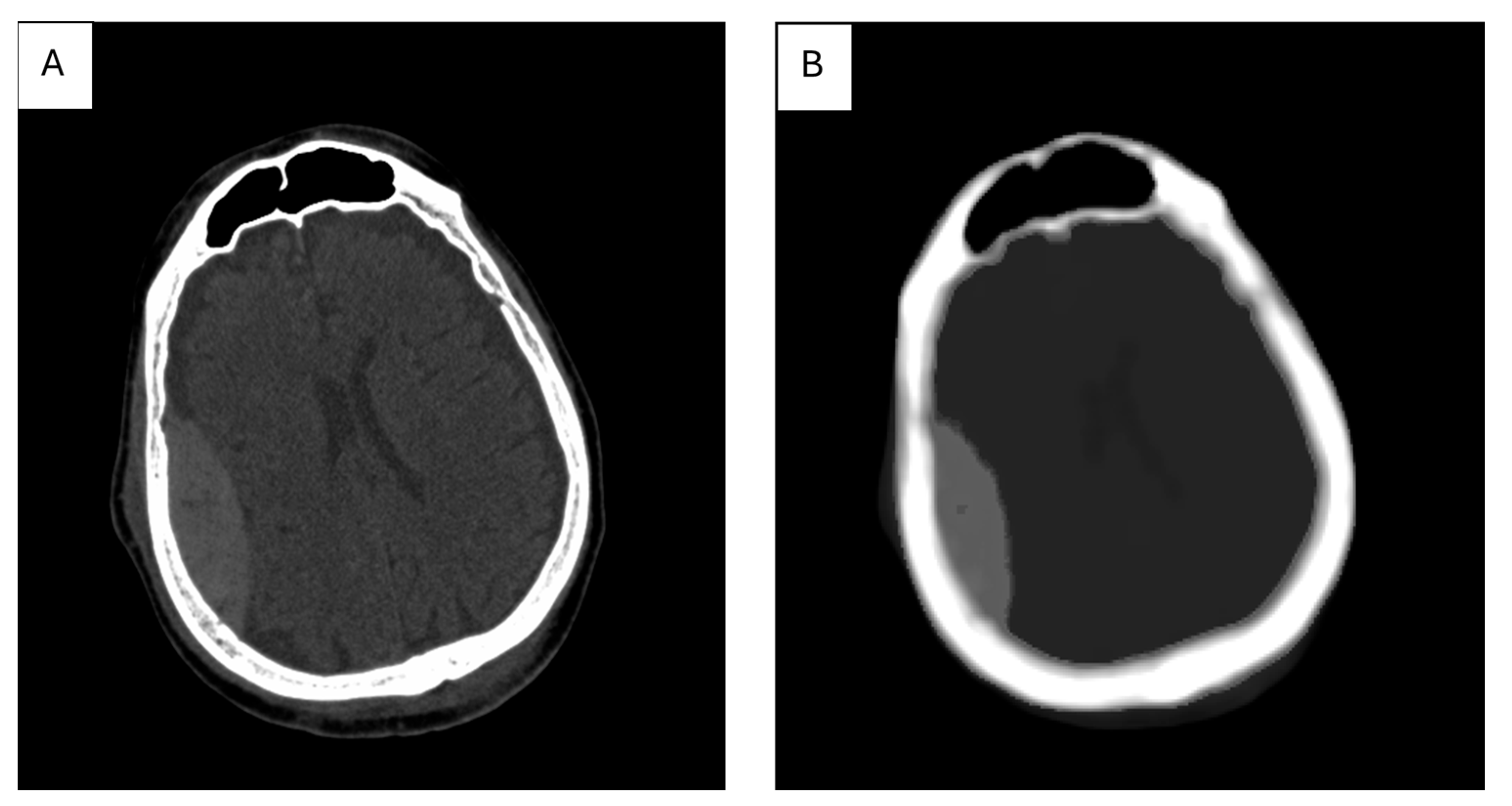 Diagnostics 15 00282 g004