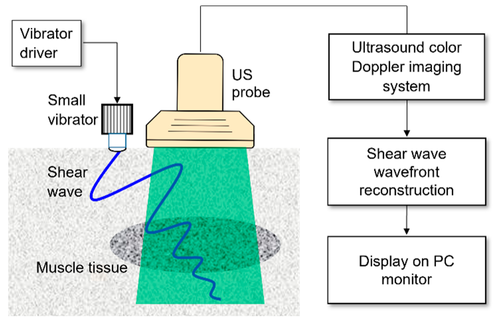 Diagnostics 15 00293 g001