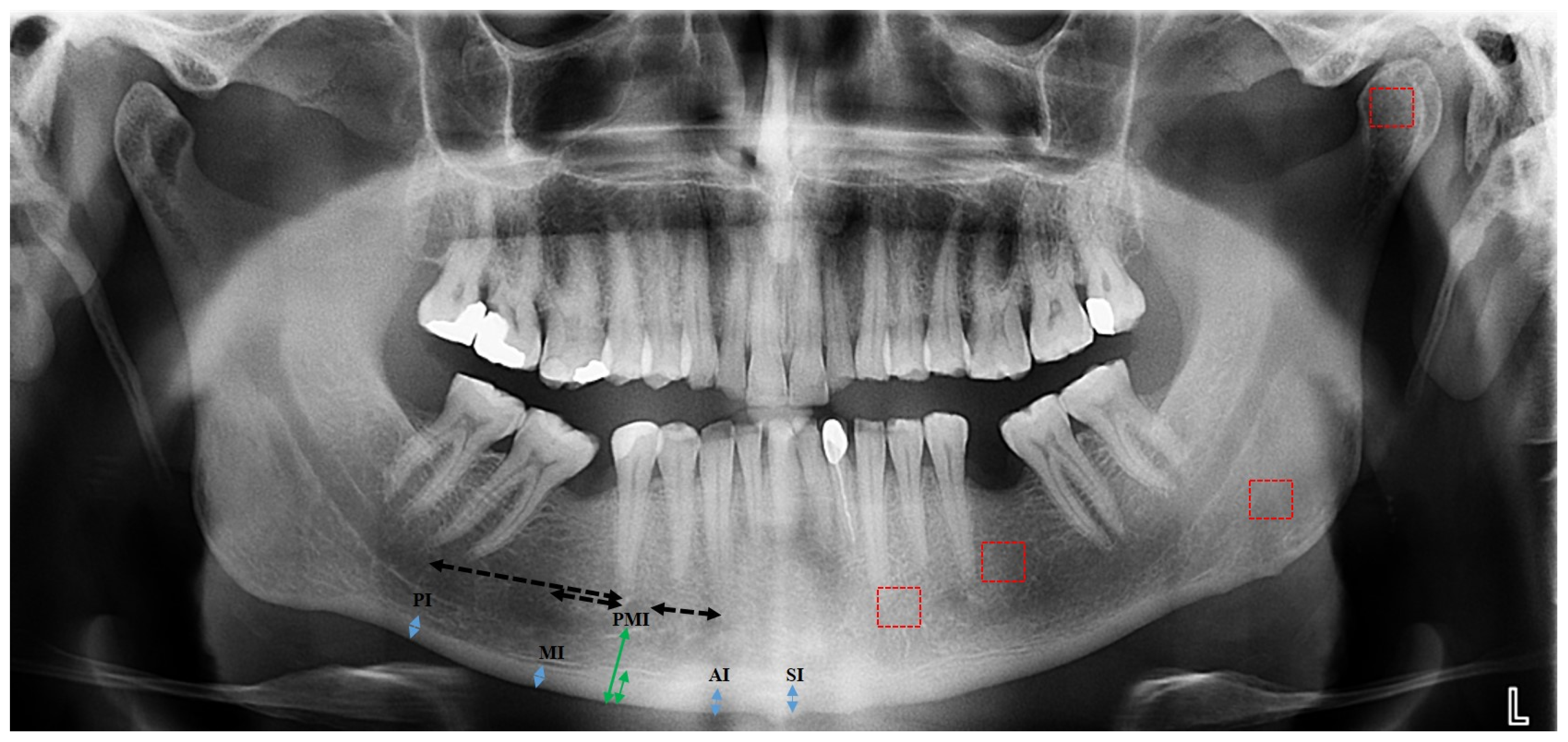 Diagnostics 15 00306 g001