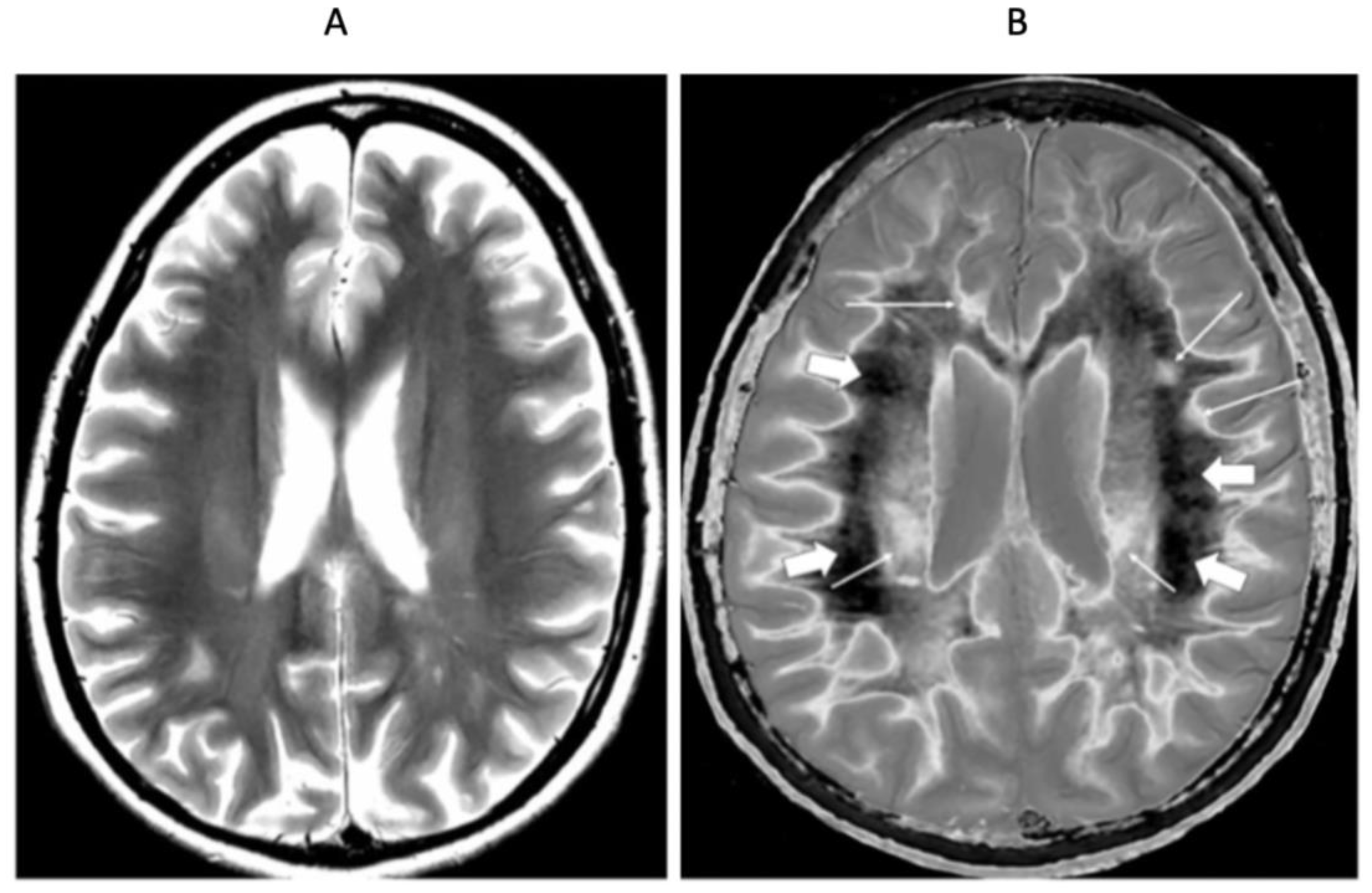 Diagnostics 15 00329 g006