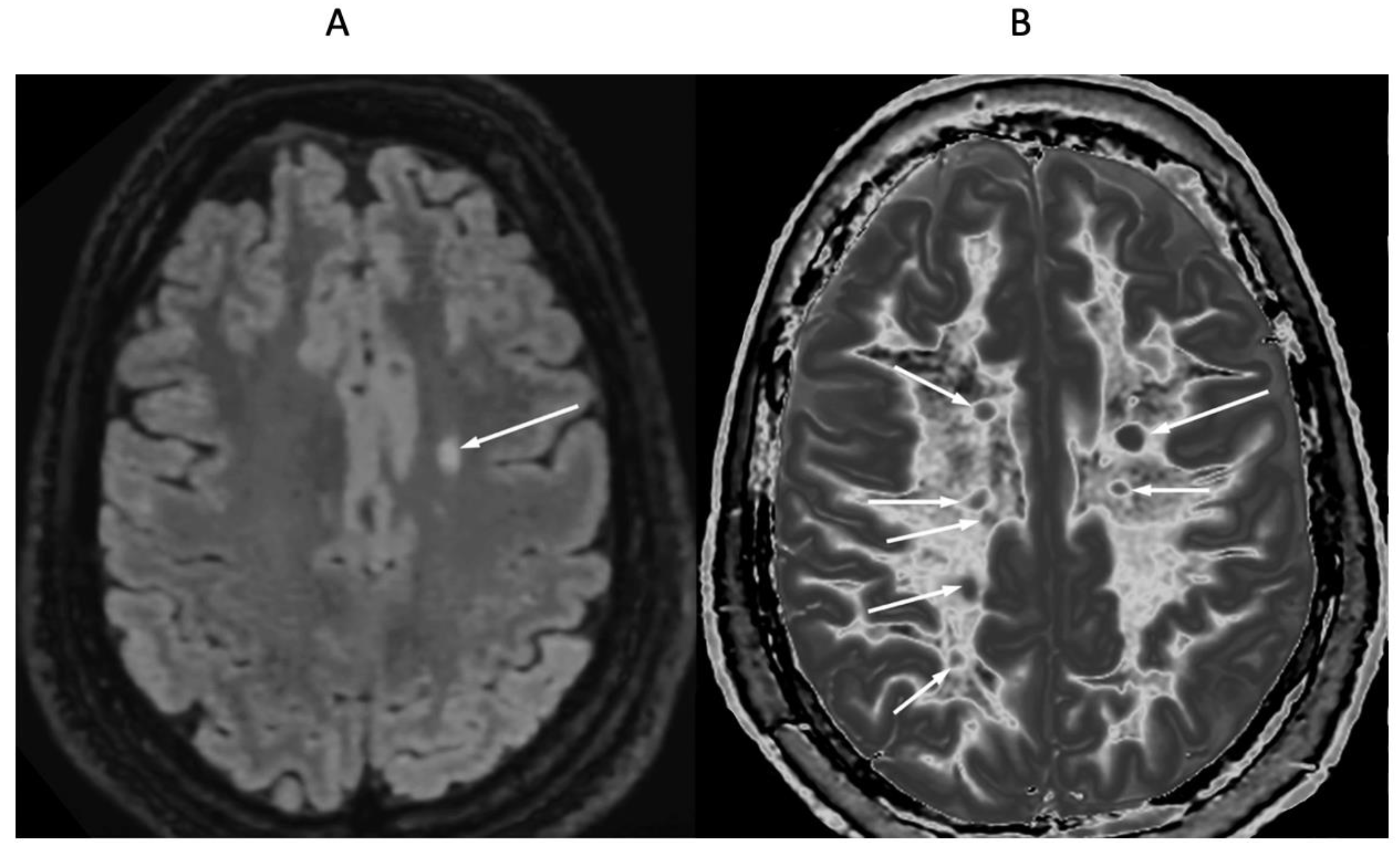 Diagnostics 15 00329 g008