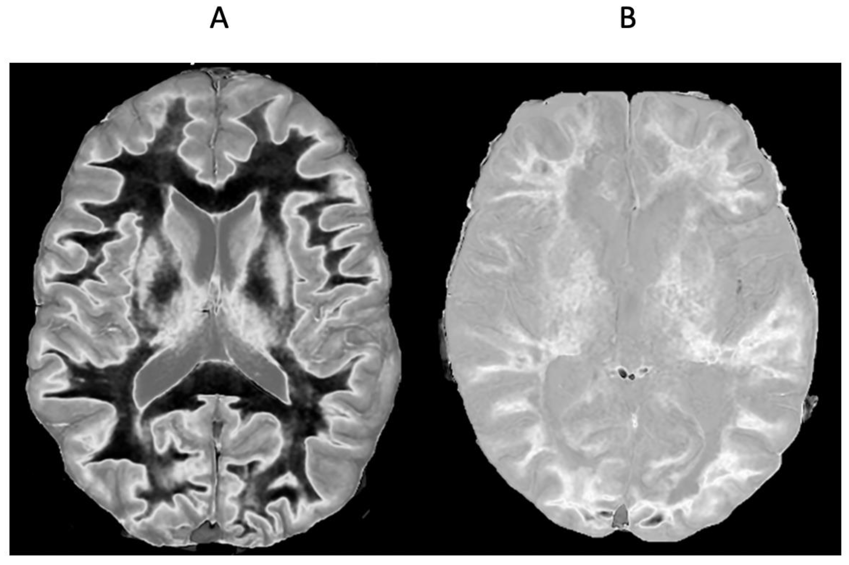 Diagnostics 15 00329 g011
