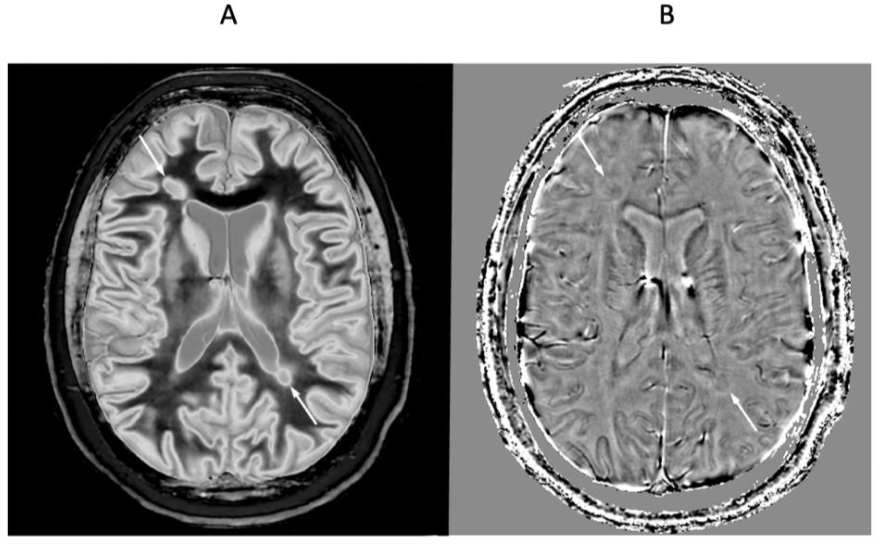 Diagnostics 15 00329 g012