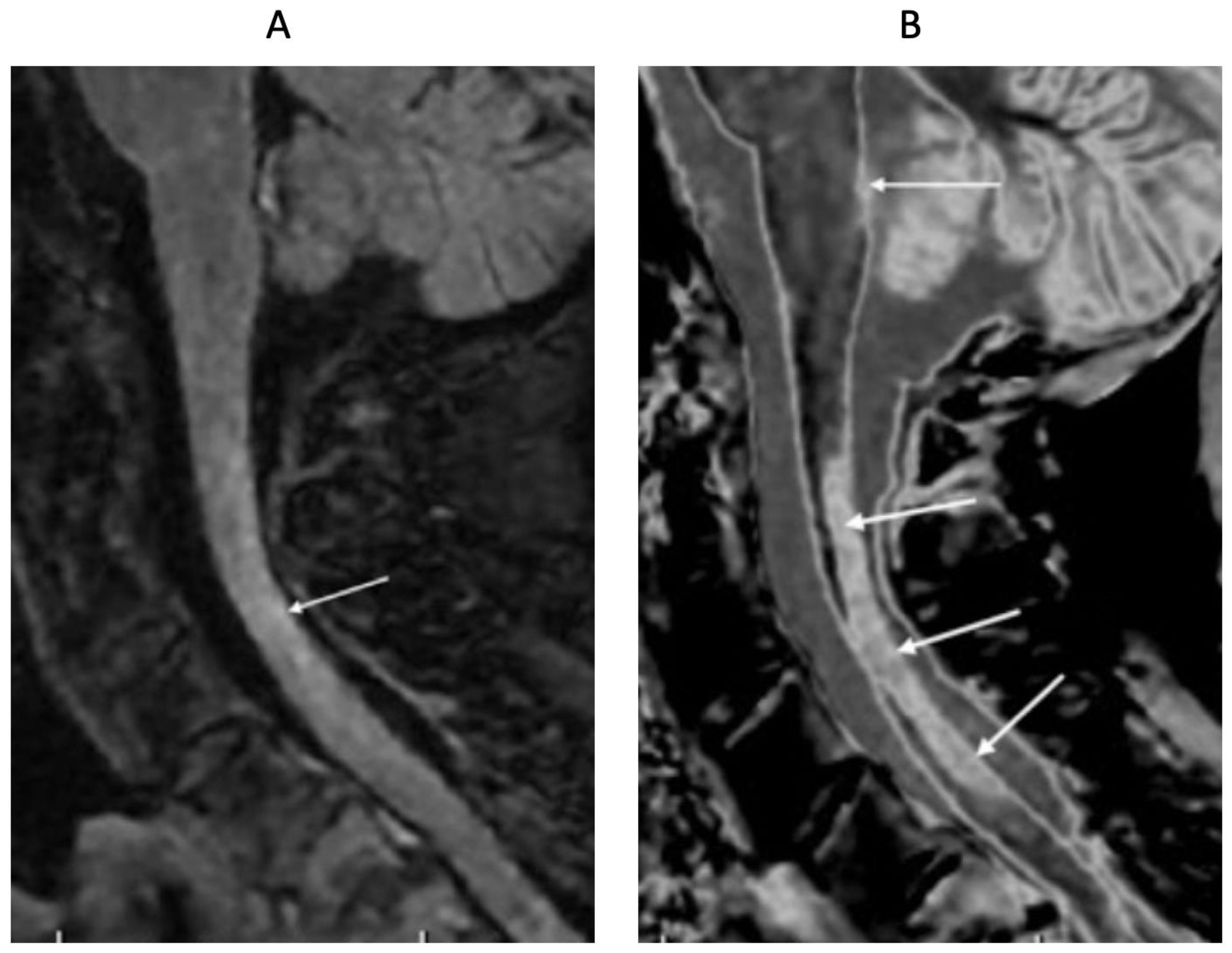 Diagnostics 15 00329 g015