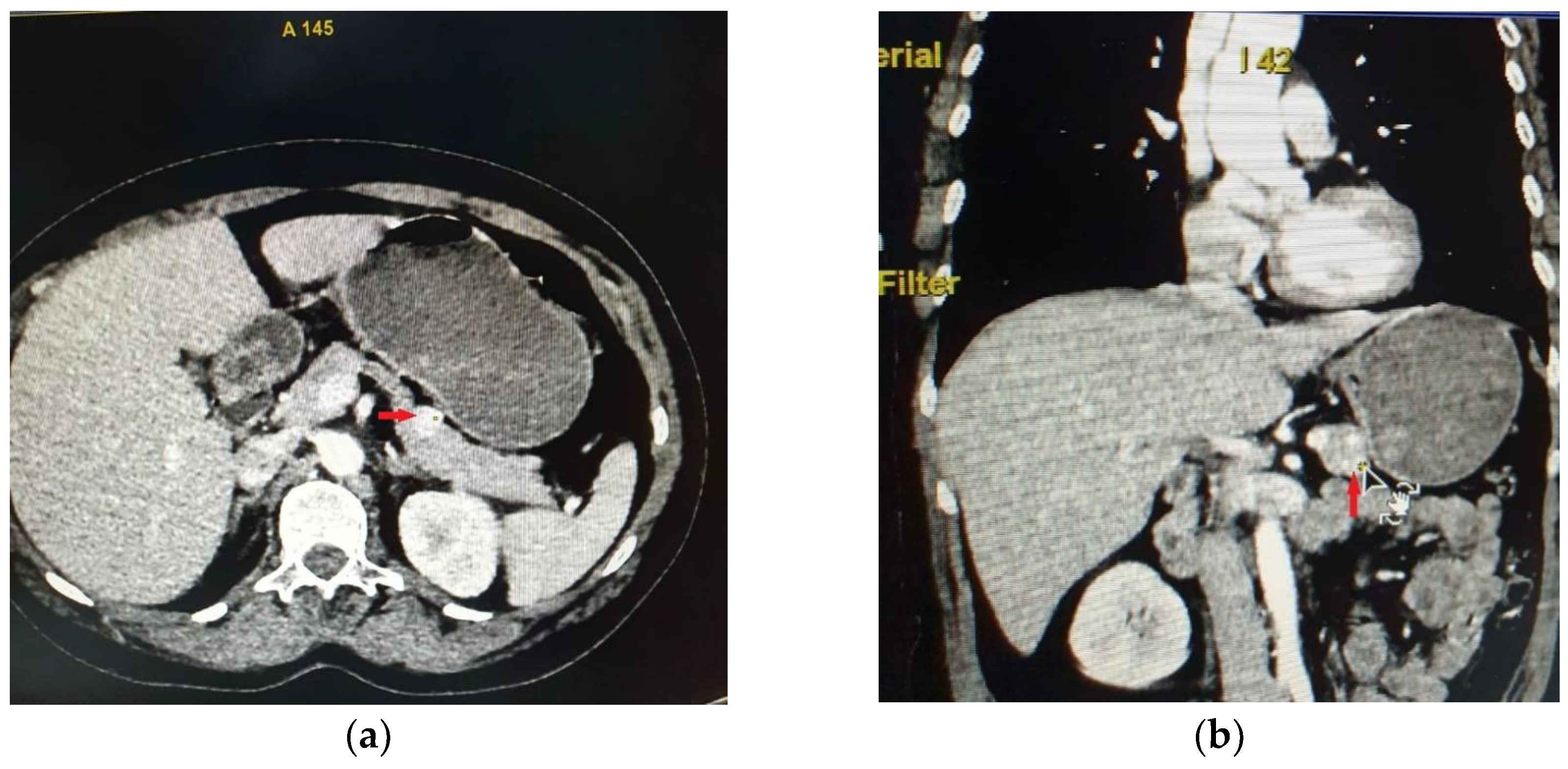 Diagnostics 15 00337 g001